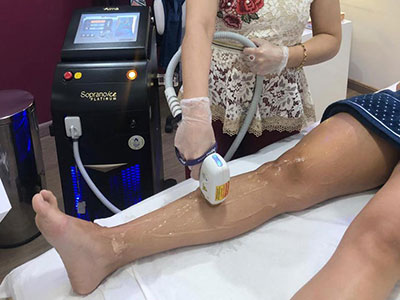 Clínica de depilação a laser na Anália Franco da Danielle Oliveira