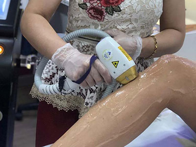 Depilação a laser para mulheres no Tatuapé da Danielle Oliveira