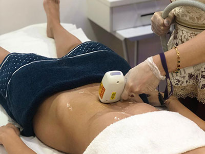 Depilação a laser peito no Tatuapé da Danielle Oliveira