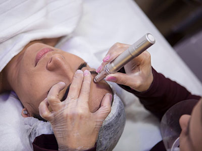 Tratamento Facial Para Controle De Acne Freguesia Do Ó da Danielle Oliveira